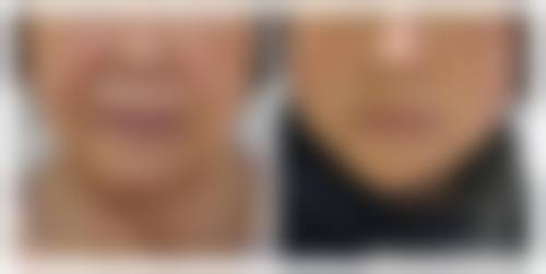 佛山医博士整形美容门诊部价格参考