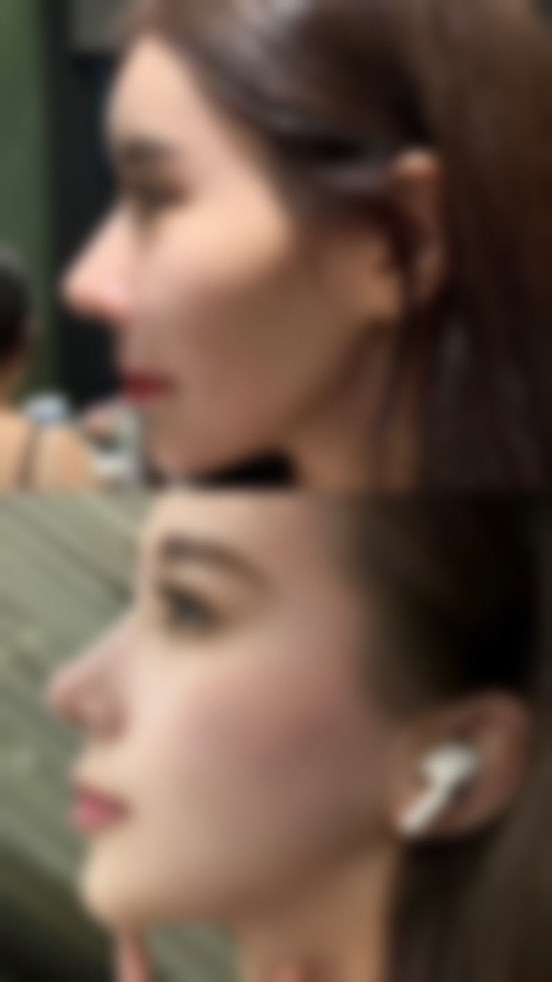 禹政浩预约方式及价格表