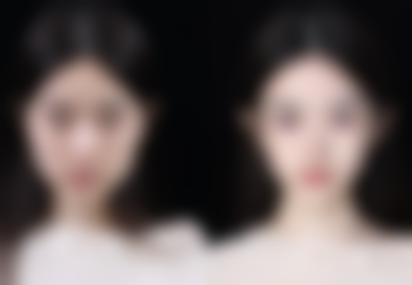 青岛韩佳人医疗美容门诊部患者反馈