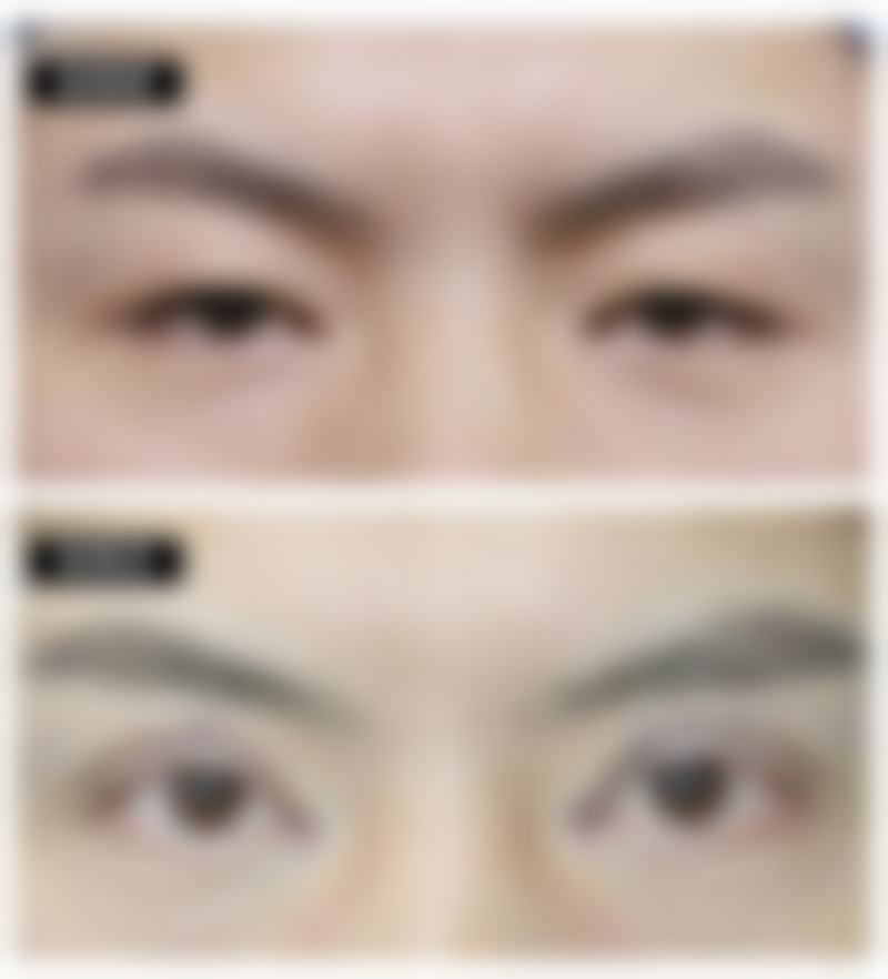 福州名韩整形美容医院价格参考