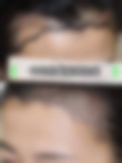 惠州刘伟勇医疗美容诊所正规资质