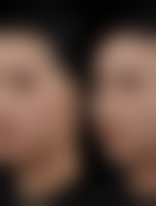 淄博星采医疗美容诊所核心项目