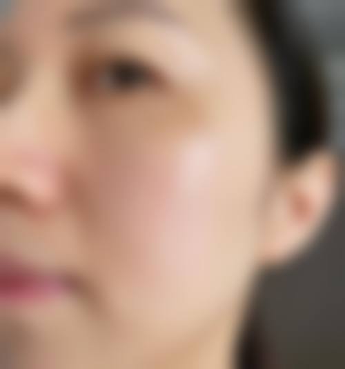 安阳皇城医疗美容诊所求美者反馈