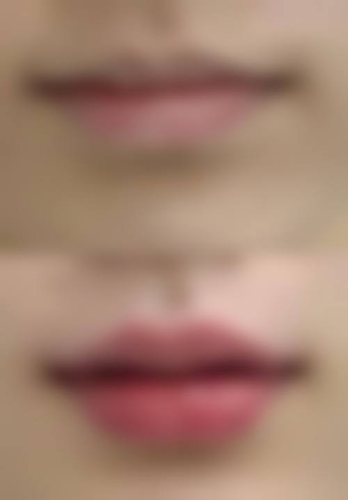 上海复旦大学附属华东医院整形美容科价格参考