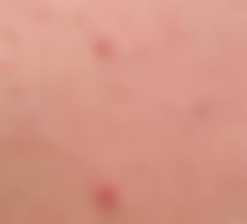 哈尔滨华美医疗美容门诊部交通路线与预约