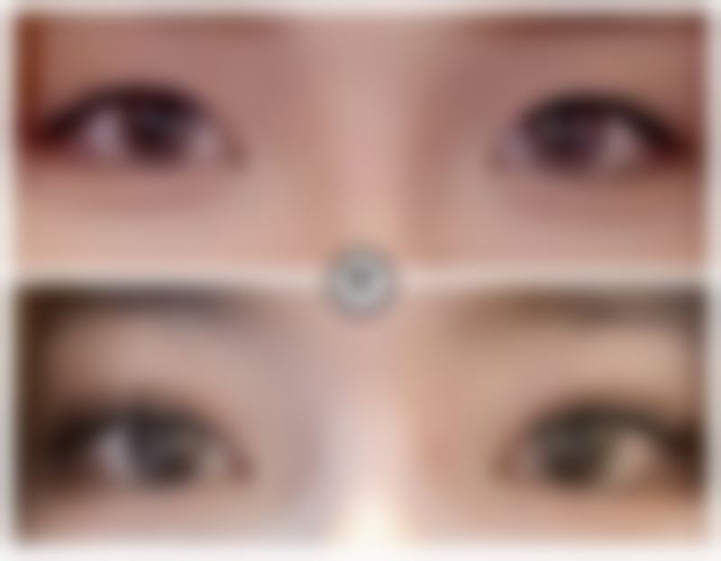 哈尔滨华美医疗美容门诊部价格参考