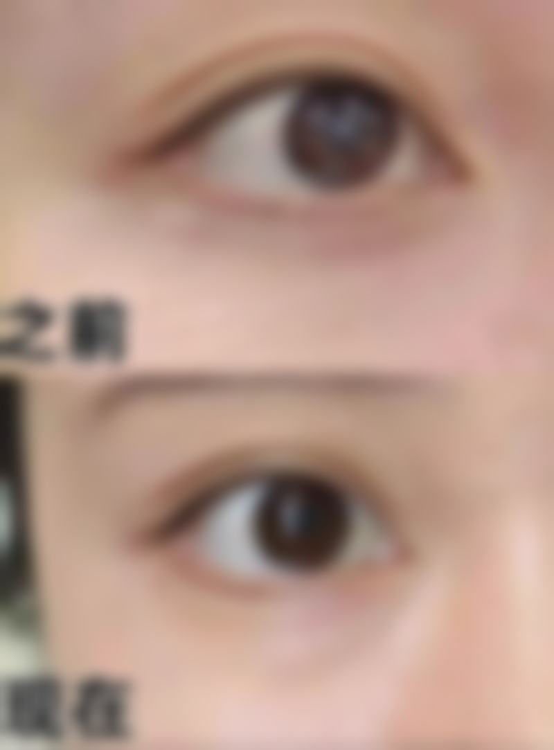 上海复旦大学附属华东医院整形美容科核心项目