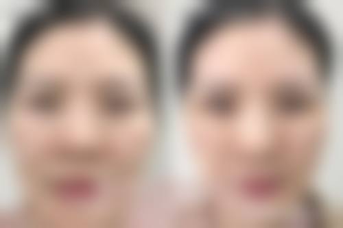 重庆艾薇美医疗美容门诊部患者评价