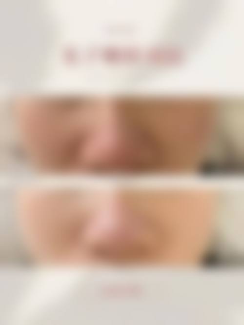 韩国欧琳娜olina整形医院核心项目