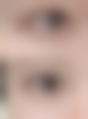 南昌华瑞出色医疗美容医院价格参考