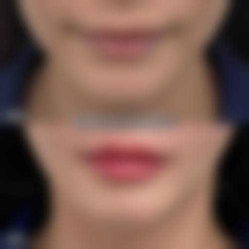 宝鸡韩美整形美容医院核心项目