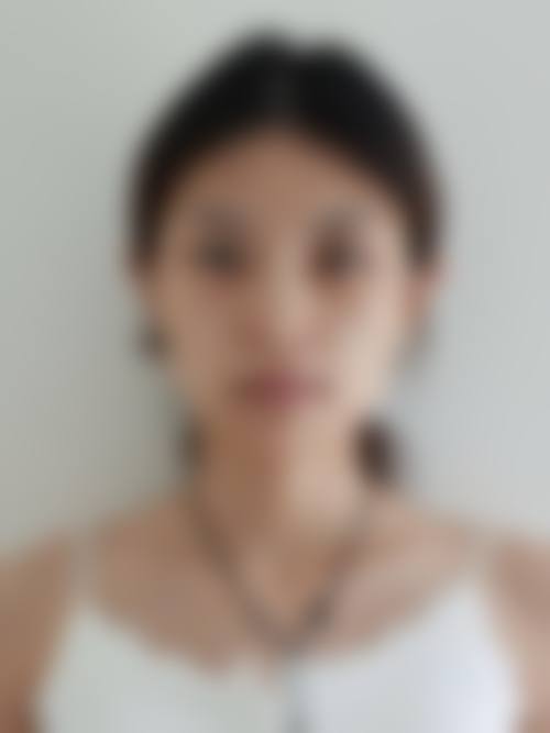 韩国Beauty Line整形外科医院患者评价