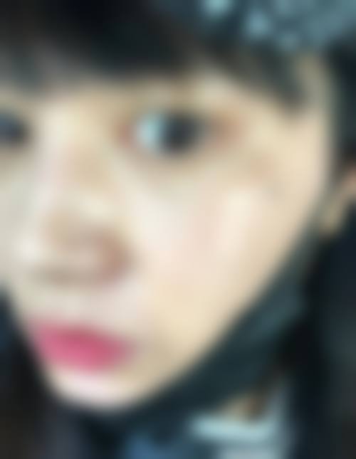 荆州蓝鸟美啦医疗美容诊所价格参考