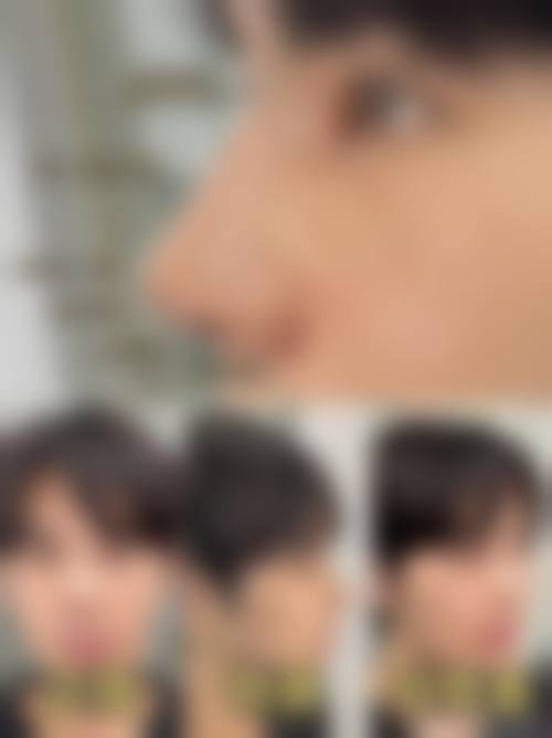 宁波和平博悦美容医院整形科价格参考