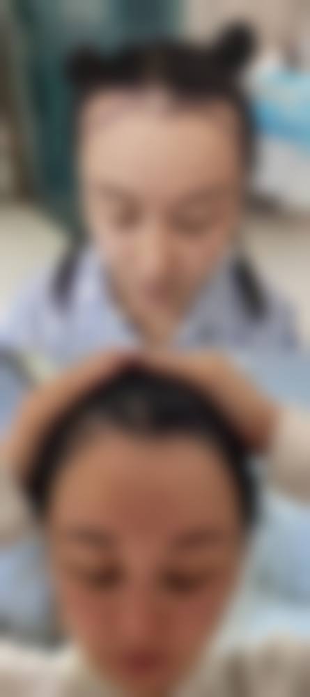 济南碧莲盛植发医疗美容诊所价格参考