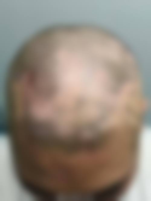 济南碧莲盛植发医疗美容诊所医生团队