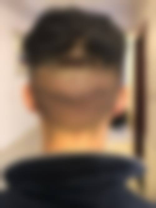 济南碧莲盛植发医疗美容诊所核心项目