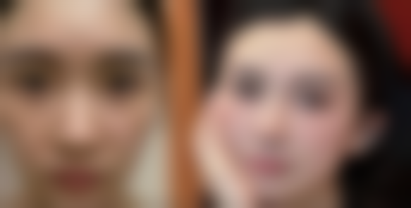 宁波和平博悦美容医院整形科核心项目