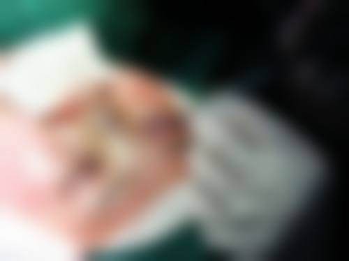 玉溪医梵整形医院患者反馈