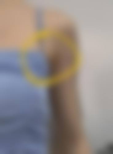 常州广化医院整形美容外科价格参考