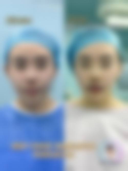 武汉言瑾整形医院价格参考