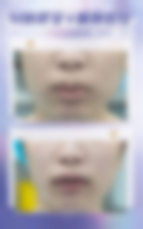 武汉言瑾整形医院核心项目