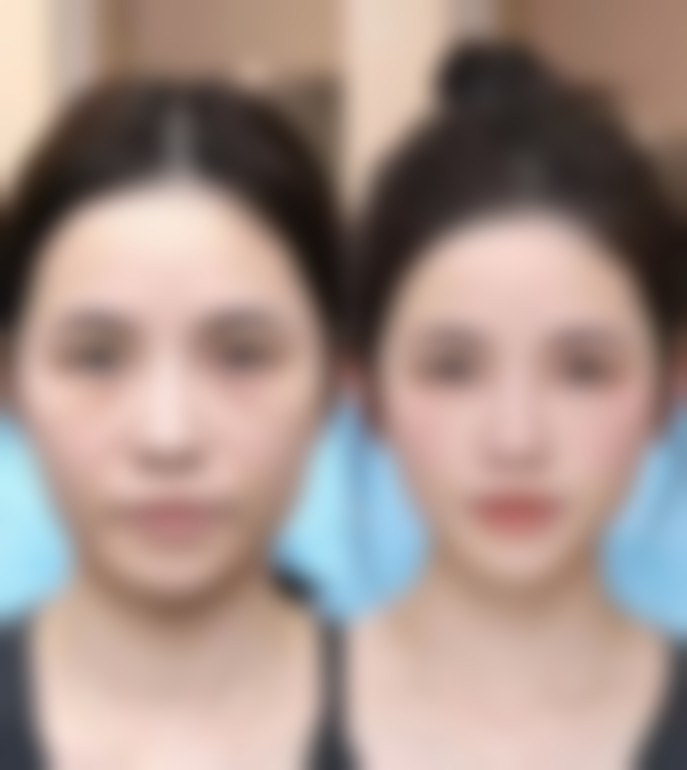 濮阳市第三人民医院烧伤整形中 心价格参考