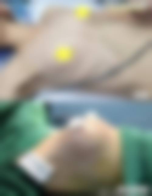 深圳联合丽格文心医疗美容诊所用户反馈