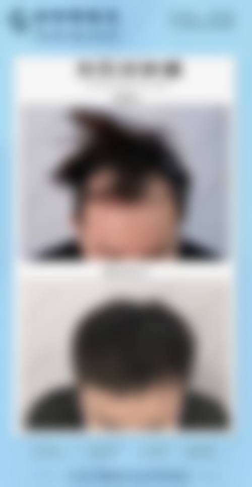 南宁美嘉美整形医院患者评价