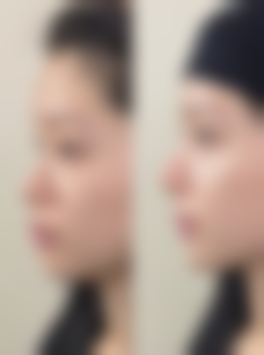 保定娇美肤美容美体医院整形科患者评价