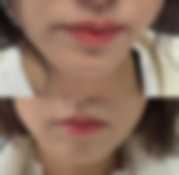 阜阳王永功医疗美容诊所核心项目