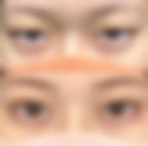 张家界玉名韩雅妍医疗美容诊所患者反馈