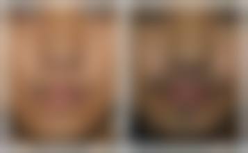 广州恒健医院医疗美容中 心核心项目