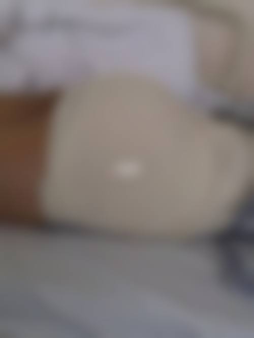 宁波摩范植发门诊部核心项目