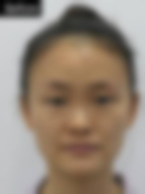 广州恒健医院医疗美容中 心价格参考