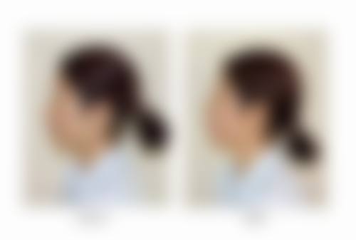 宁波摩范植发门诊部交通路线与预约