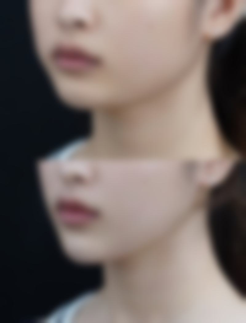 绵阳江油白天鹅整形美容医院正规资质