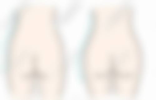 沧州星悦（原中妤）整形患者反馈