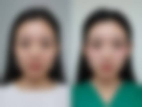 成都芊妍美度医疗美容门诊部患者评价