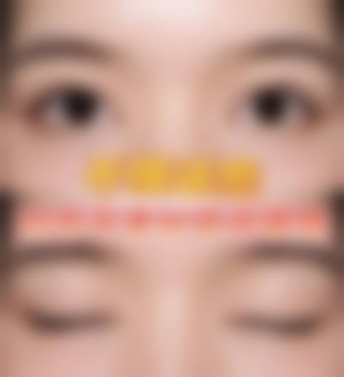 韩国Chiu整形外科核心项目