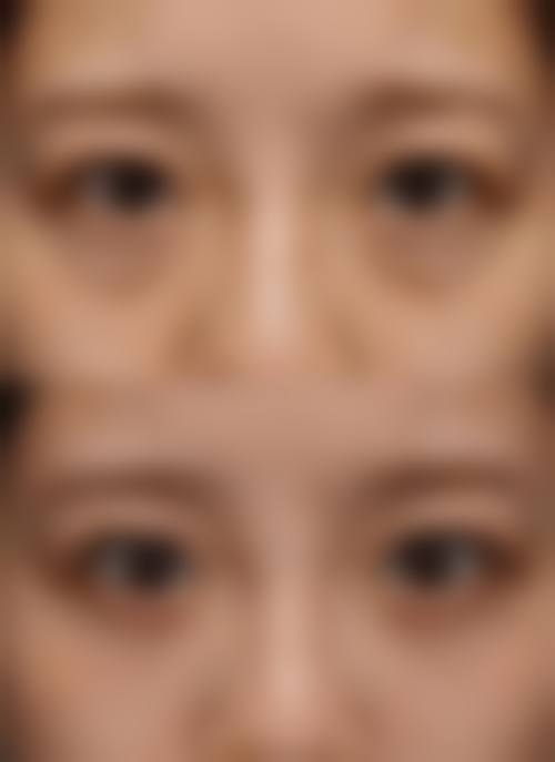 韩国Chiu整形外科交通路线与预约方式