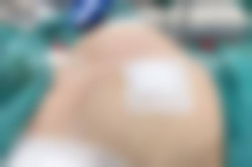 苏州澳美整形医院交通路线与预约