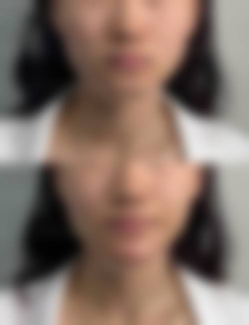 徐州纳希美医疗美容医院核心项目