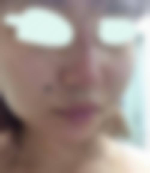 徐州纳希美医疗美容医院患者评价