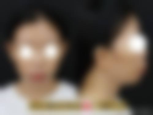 河源李陵峰医疗美容诊所核心项目