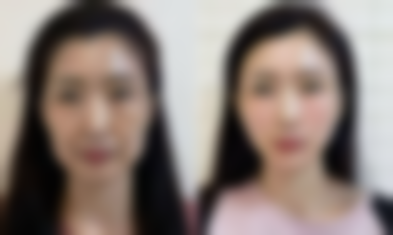 陈秋珍预约方式及价格表