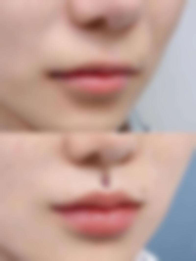 厦门华美整形医院地址及到院路线