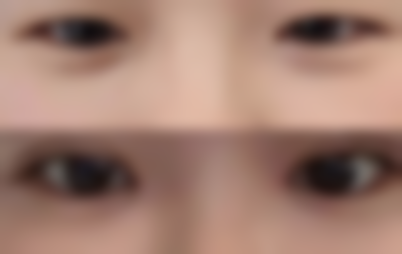 广州焕新医疗美容诊所核心项目