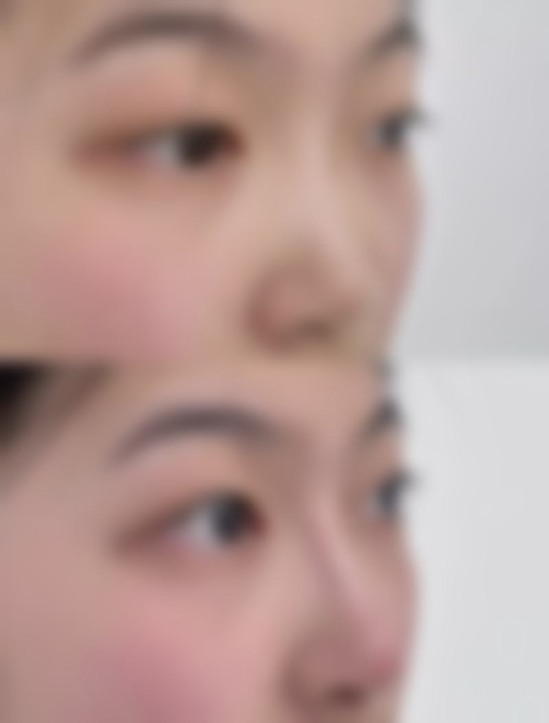 杭州缇恩整形医院求美者反馈