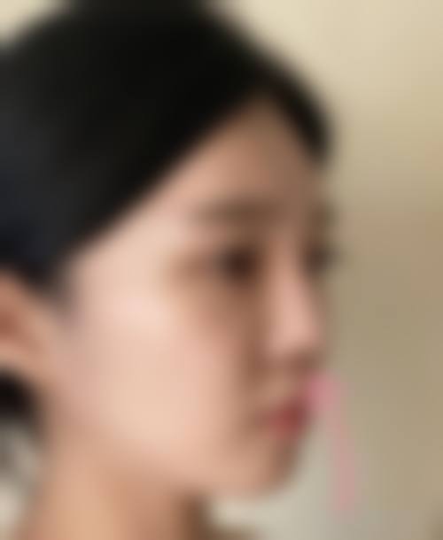 韩国MOTIVE整形外科医院核心项目